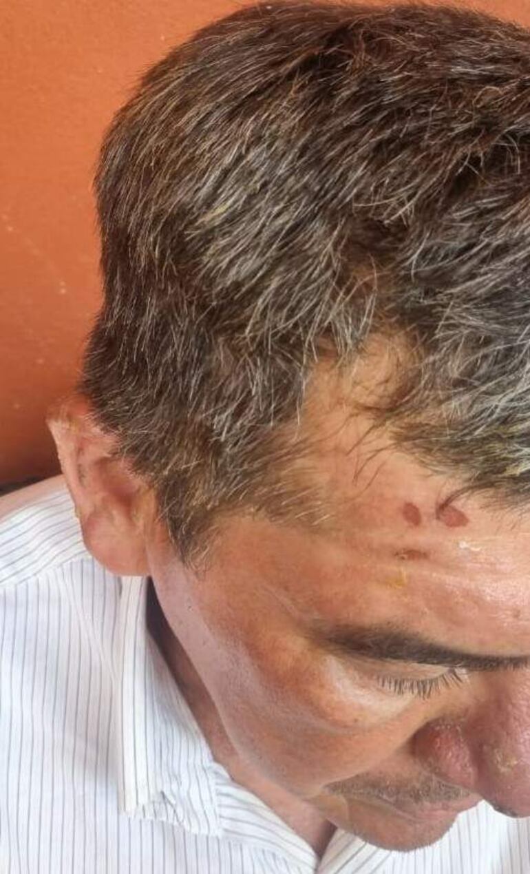 Don Severiano Medina Ortiz resultó con heridas varias tras intentar salvar sus pertenencias