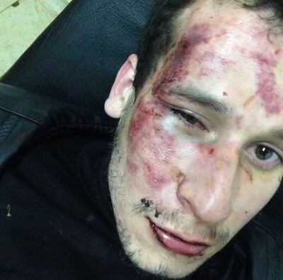 /pf/resources/images/abc-placeholder.png?d=2394