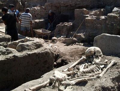 Era un niño cuando hubo que amputarle parte de la pierna izquierda, operación que superó y llegó a la juventud. Un caso que hoy no sería extraño, pero este ocurrió hace 31.000 años y es la evidencia más antigua de un procedimiento de este tipo.