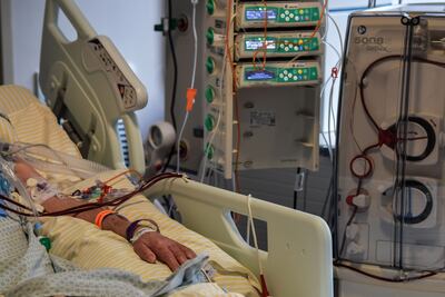 Un paciente con covid-19 en terapia intensiva en el hospital Albert Einstein de Sao Paulo, Brasil.