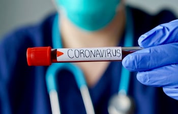 Un equipo de expertos de la OMS ya visitó China los pasados meses de julio y febrero para investigar sobre los orígenes del coronavirus, aunque en ambas ocasiones apenas trascendieron detalles.