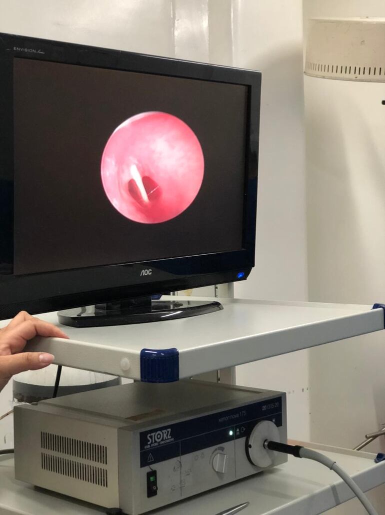 Un equipo multidisciplinario realizó el procedimiento médico.