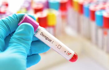 Una técnica de laboratorio sostiene una muestra de sangre positiva para el virus del dengue.