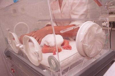 Los bebés prematuros son los que más requieren de cuidados intensivos, según datos.