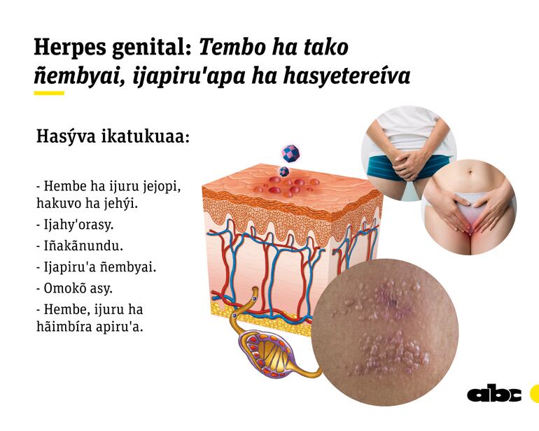 Ilustración referencial sobre conceptos de enfermedades de transmisión sexual del libro Tesâirâ, Guaraní Médico, del profesor Carlos Ferreira.