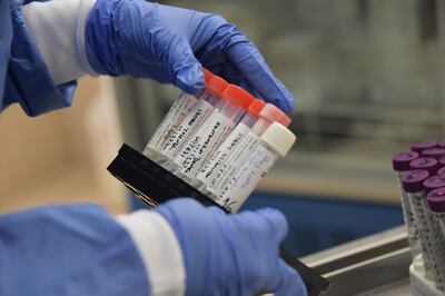 Muestras para analizar laboratorialmente en busca de coronavirus.