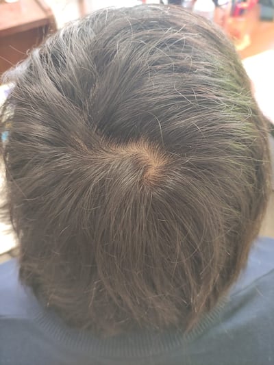 /pf/resources/images/abc-placeholder.png?d=2394