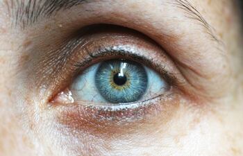 Son muy útiles las lágrimas artificiales que ayudan a lubricar los ojos y a expulsar solo con el parpadeo cualquier cuerpo extraño que haya penetrado en el ojo (ceniza, arenilla). Estas gotas producen un efecto de lavado, sin necesidad de tocar los ojos.