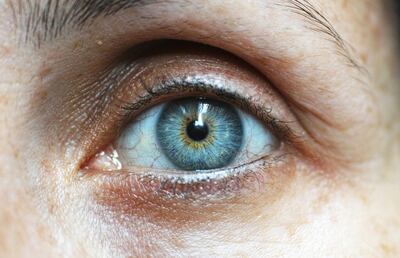 Son muy útiles las lágrimas artificiales que ayudan a lubricar los ojos y a expulsar solo con el parpadeo cualquier cuerpo extraño que haya penetrado en el ojo (ceniza, arenilla). Estas gotas producen un efecto de lavado, sin necesidad de tocar los ojos.