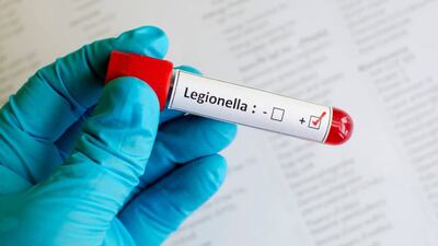 Los casos de neumonía reportados en Argentina, es causa de la bacteria intrahospitalaria legionella.