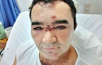 El hombre quedó hospitalizado por dos días debido a las lesiones.
