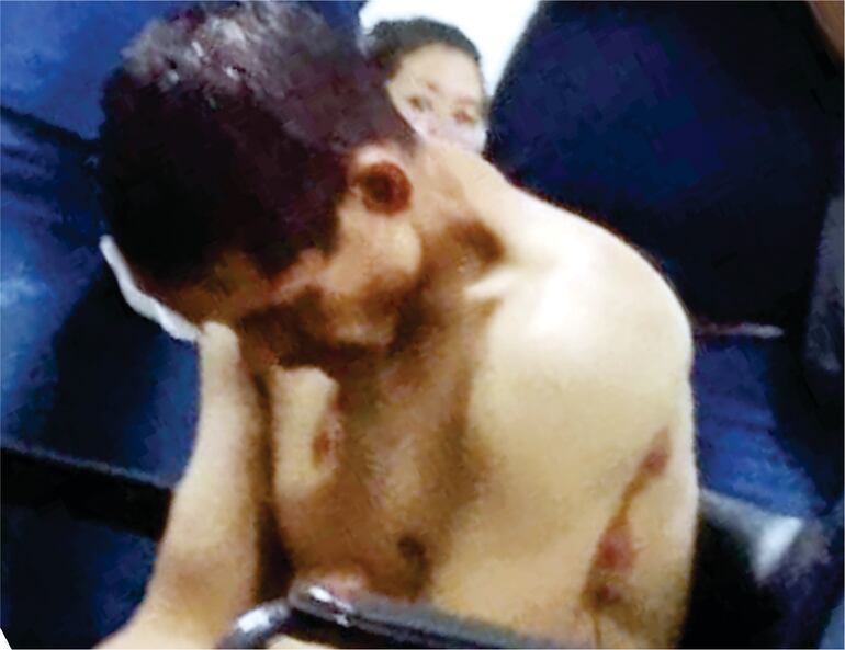 El malviviente identificado como, Eduardo Ariel Vera (37), terminó con una herida de bala en la zona axilar lado izquierdo de su cuerpo.