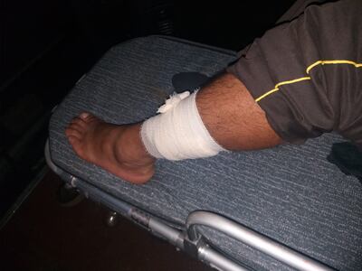 El guardia de seguridad fue asistido en el Hospital Regional de Ciudad del Este.