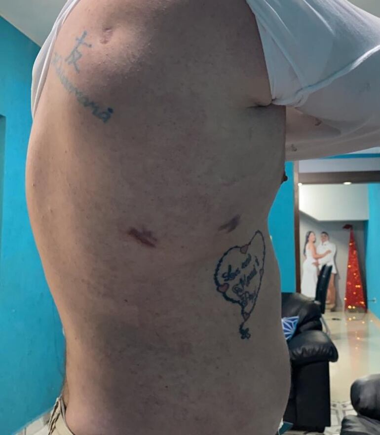 /pf/resources/images/abc-placeholder.png?d=2393