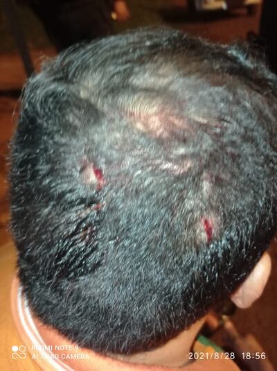 De acuerdo al relato del afectado, el incidente se produjo alrededor de las 18;45 del domingo, al término de una caravana que un grupo político opositor al candidato a intendente colorado, Pedro Chávez (ANR Cartista).
Leiva Vera es vocero del grupo opositor que nuclea a activistas de varios partidos, entre ellos el colorado, mientras que su supuesta agresora es partidaria del candidato colorado a la intendencia, el ex intendente Pedro Chávez (ANR cartista).
Según relató el denunciante, luego de terminado el acto en la plaza pública se dirigía a su casa, pero se vió oligado a detener la marcha porque se le había pinchado un neumático del vehículo. En ese momento llegó Romero, a bordo de una camioneta acompañada de su marido, Osvaldo Cabral Duarte.
Esta señora comenzó a insultarme y agredirme de palabra. Yo no le hice caso, y seguí con la tarea, refirió. En un momento dado, me agaché para colocar la rueda, la mujer me atacó con varios golpes de pistola en la cabeza. Forcejeé con ella y le quité la pistola, y con ayuda de otras personas llamamos a la policía, al 911. Al llegar la patrulla le entregamos la pistola a los agentes policiales, refirió.
Posterior a la denuncia policial hizo lo propio ante la fiscalía del crimen, a cargo del fiscal Walter Castro. Para mañana (martes) tenemos audiencia testifical ante la fiscalía, dijo Leiva, quien recordó que varias personas pudieron ver el incidente y la agresión de que fue objeto.
Esta no es la primera vez que esta persona tiene este tipo de comportamientos violentos, también en el pasado agredió al director del hospital distrital de Mayor Otaño, pero esa vez no hubo denuncia. Yo tomé la determinación de denunciar porque este tipo de comportamientos por diferencias políticas no se pueden permitir, sostuvo.
No pudimos contactar con la mujer denunciada para obtener su versión de los hechos, que ahora están a cargo de la fiscalía su investigación.