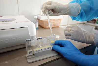 La OMS garantizó  que no avalará ninguna vacuna experimental sin que haya un convencimiento total de que es segura y eficaz para prevenir el covid-19.