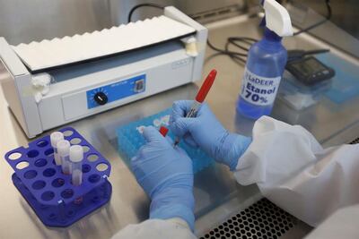 Investigadores trabajan con muestras de la Covid-19 ayer, en el Laboratorio de Diagnóstico en Enfermedades Emergentes y Reemergentes (LaDEER) de la Universidad de Guadalajara (UDG), estado de Jalisco (México).