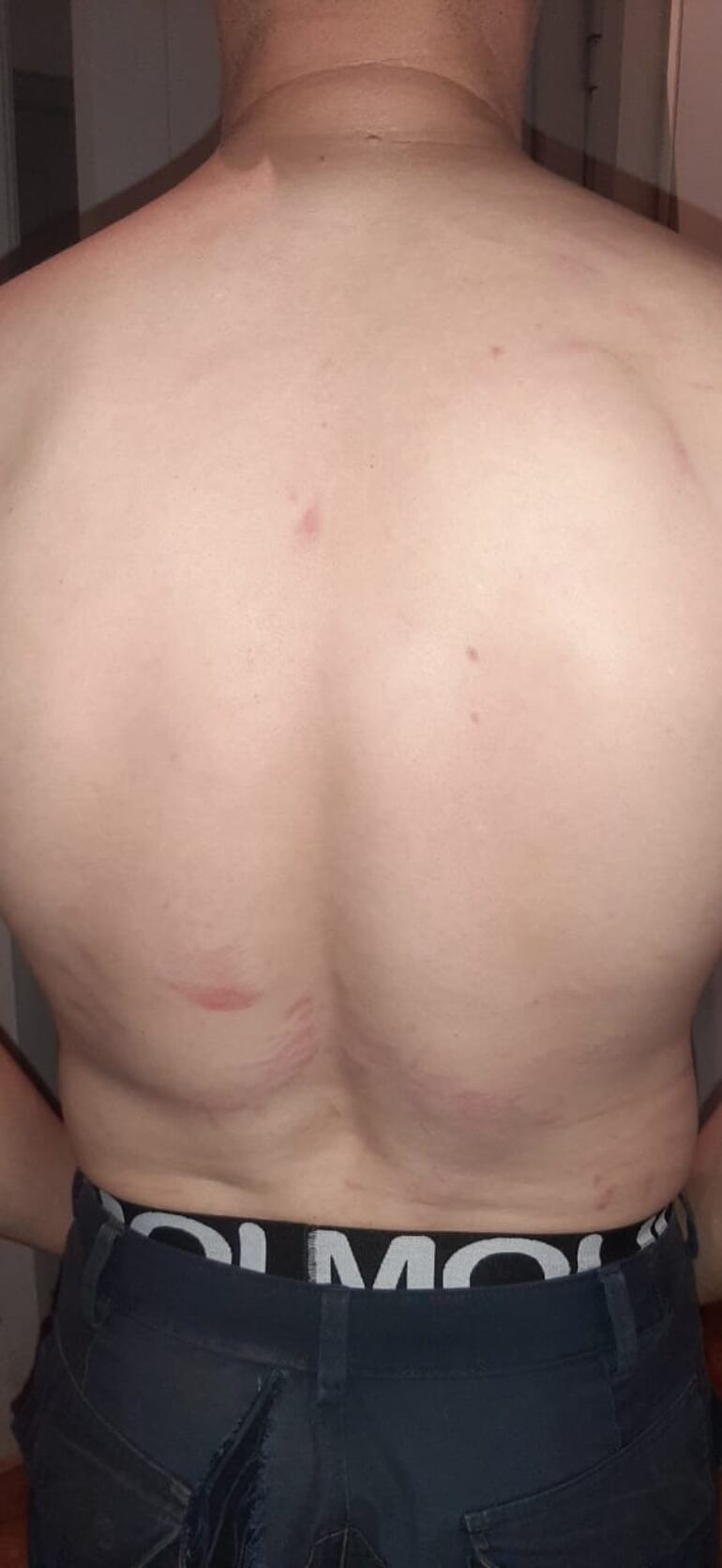 Otro de los uniformados recibió varios golpes en la espalda.