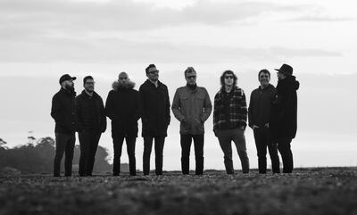 La agrupación uruguaya ya lleva 26 años de trayectoria en la música con discos y DVD editados.