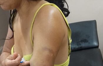La victima sufrió golpes y quemaduras en varias partes del cuerpo.