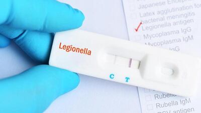 Ascienden a seis los fallecidos por Legionella en provincia argentina.