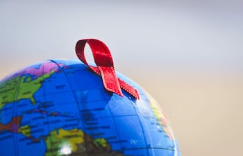 Una estadounidense se convirtió en la tercera persona y primera mujer posiblemente curada del VIH, después de haber sido sometida a un trasplante de células madre.