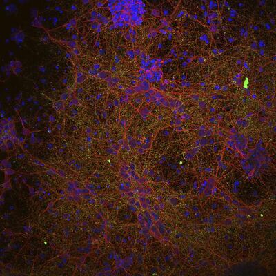 Imagen microscópica de células neurales con nanopartículas de óxido de hierro neuronas (rojo), sinapsis (verde) y núcleos celulares (azul). La ciencia de los materiales, la medicina regenerativa y la nanotecnología han abierto una prometedora vía de trabajo para tratar de encontrar soluciones eficaces para reparar las lesiones medulares, en el marco de un proyecto de investigación pionero en el mundo en el que se van a implicar seis países europeos.