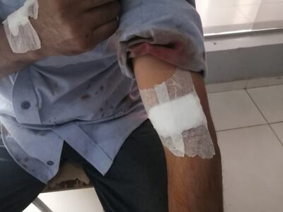 El vendedor fue herido durante el asalto.