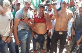 Campesinos muestran sus heridas producidas tras los incidentes.