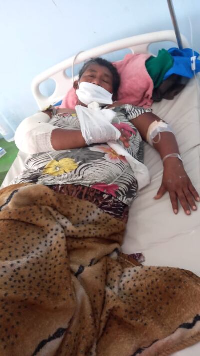 La paciente se recupera después de la cirugía en el Hospital Regional de Concepción.