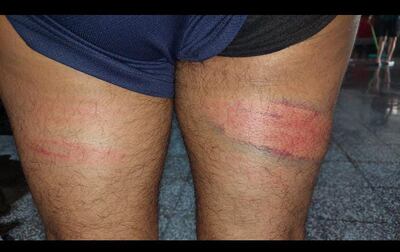 Denuncian agresión en la Agrupación Especializada de la Policía Nacional.