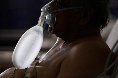 Un paciente con coivd-19 en terapia intensiva en el hospital San Roque de la ciudad de Córdoba, Argentina.