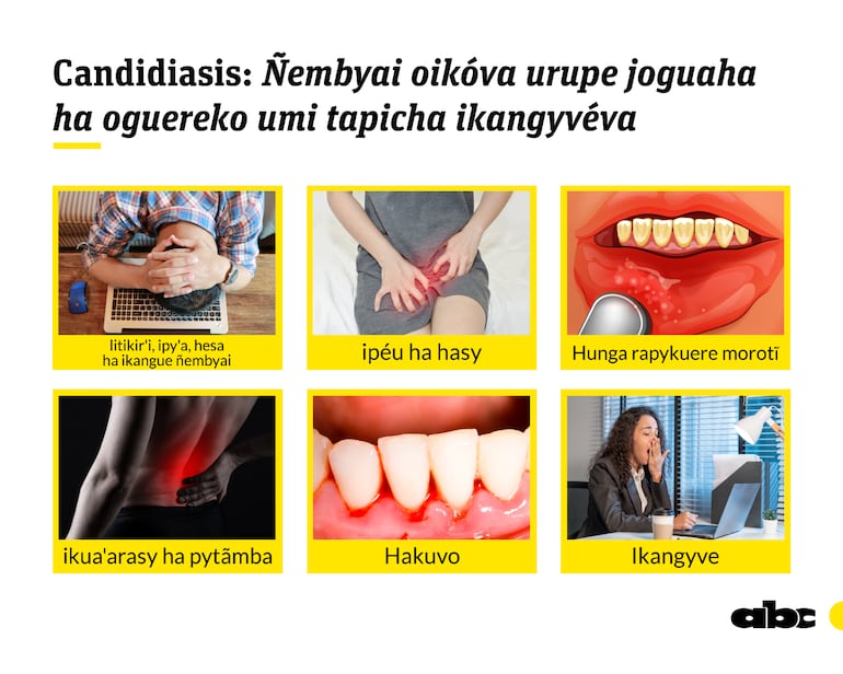 Ilustración referencial sobre conceptos de candidiasis del libro Tesâirâ, Guaraní Médico, del profesor Carlos Ferreira.