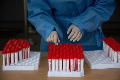 Un trabajador sanitario prepara tubos para recolectar muestras de personas en un centro de testeo en Seúl, Corea.