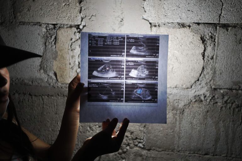 Fátima, de 14 años, muestra la radiografía de su hijo un día antes de nacer, en marzo de 2022, en Ciudad de Guatemala (Guatemala).