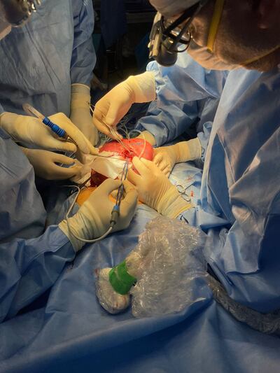 El martes se hizo la sexta operación fetal intrauterina en IPS Central. Esta vez se trata de una paciente de 34 años, oriunda de la ciudad de Capiatá.