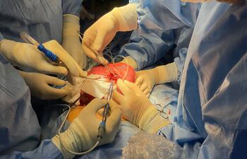 El martes se hizo la sexta operación fetal intrauterina en IPS Central. Esta vez se trata de una paciente de 34 años, oriunda de la ciudad de Capiatá.