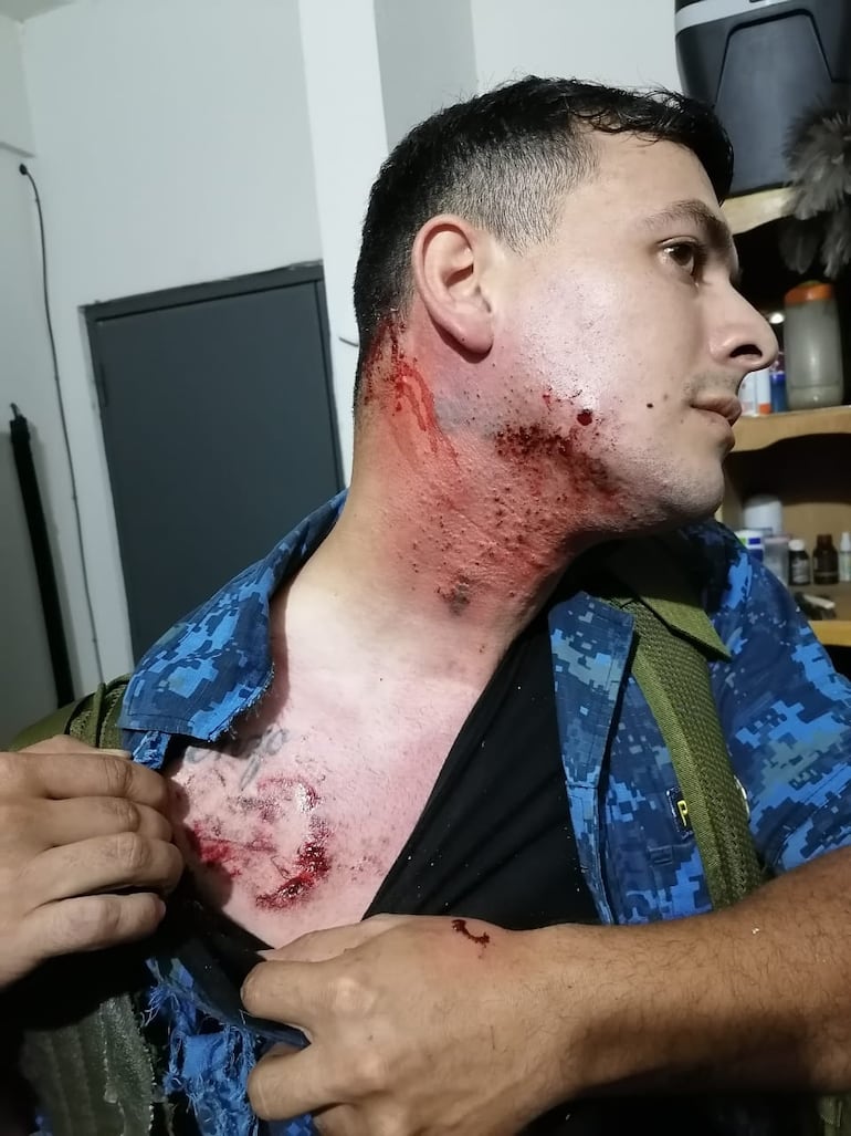 Uno de los efectivos policiales muestra las heridas que sufrió.