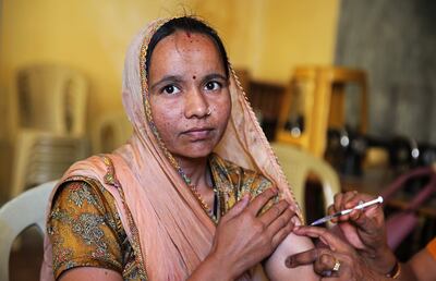 /pf/resources/images/abc-placeholder.png?d=2411