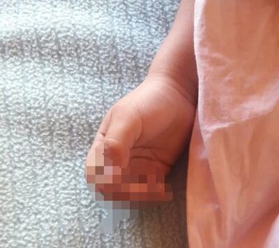 /pf/resources/images/abc-placeholder.png?d=2395