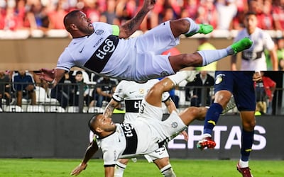 Richard Ortiz y sus dos definiciones de chilena.