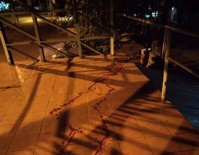 El joven indígena fue herido en el cuello y trasladado al Hospital Regional de Ciudad del Este.