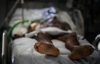 La mayor región de Bolivia ingresa en alerta roja sanitaria por la covid-19