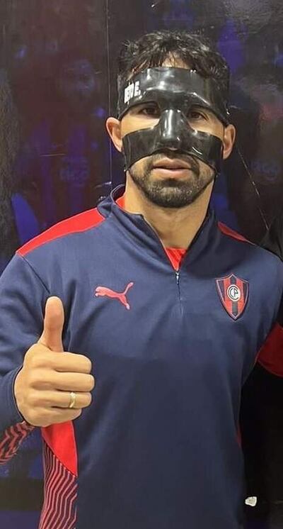 Pulgar arriba del enmascarado Alberto Espínola Giménez (31 años), expeditivo lateral derecho de Cerro Porteño.