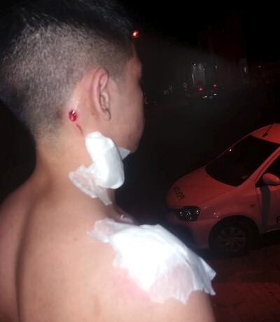 El chico que fue herido por los policías.