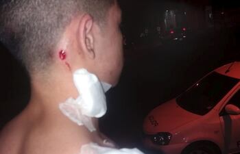 El chico que fue herido por los policías.