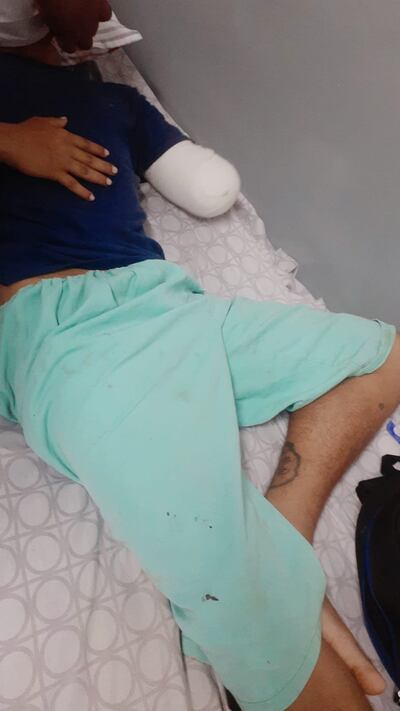 El joven no recuerda las circunstancias de cómo perdió la mano.