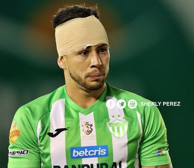 Pedro Báez anota goles para el Antigua FC de Guatemala.