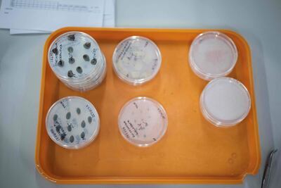 Las cámaras acorazadas están bajo tierra, en plena campiña inglesa, a una temperatura de 20º bajo cero. Pueden soportar inundaciones y bombardeos y guardan un tesoro formado por semillas de 40.000 plantas silvestres de todo el mundo, muchas de ellas en peligro de extinción.