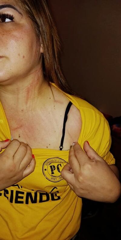 La licenciada Teresa Medina exhibió foto de que también fue víctima de agresión